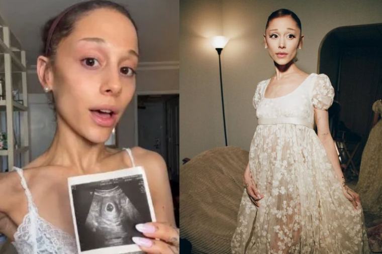 Kecoh Ariana Grande hamil anak sulung, kecewa rupanya foto ultrasound hasil AI